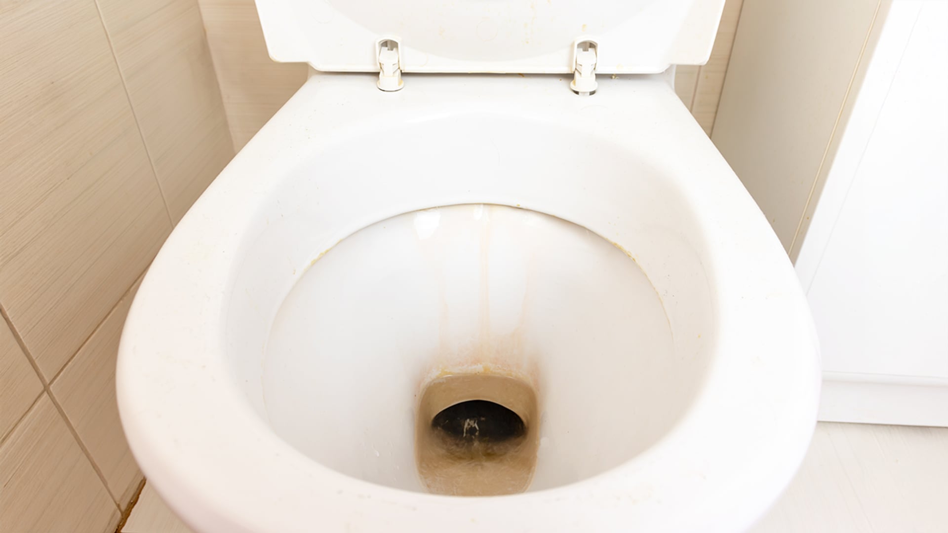 Afbeelding van Wat is urinesteen in je toiletpot en hoe kun je deze aanslag verwijderen?