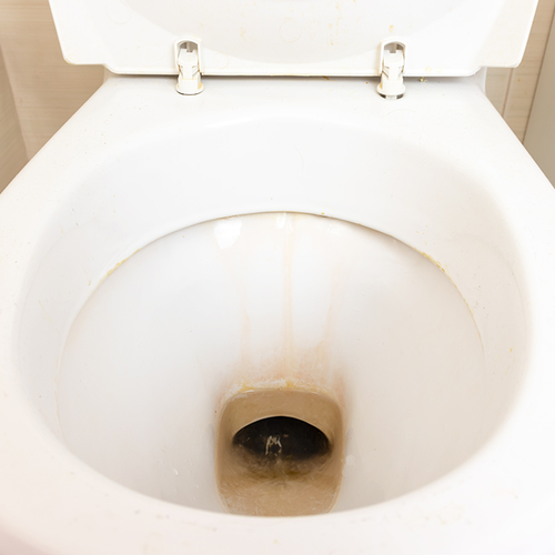 Wat is urinesteen in je toiletpot en hoe kun je deze aanslag verwijderen?