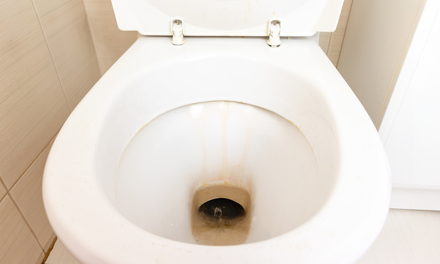 Afbeelding van Wat is urinesteen in je toiletpot en hoe kun je deze aanslag verwijderen?