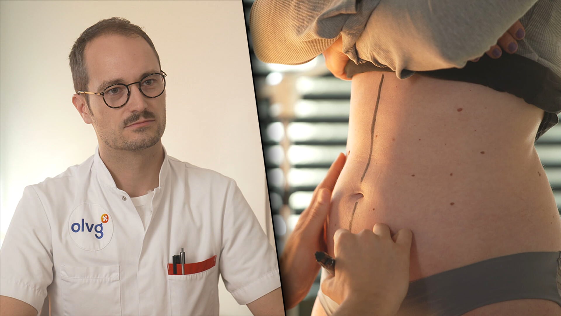 Afbeelding van Cosmetische ingrepen in Turkije: jezelf mooier maken kan soms lelijk uitpakken