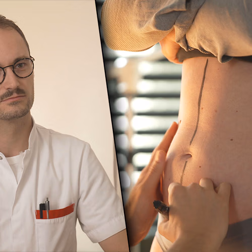 Afbeelding van Cosmetische ingrepen in Turkije: jezelf mooier maken kan soms lelijk uitpakken