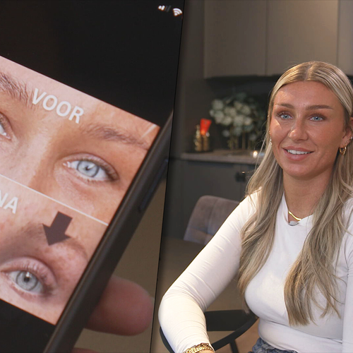 Gebruik van populaire wimperserums niet zonder risico: "Kan blijvende oogschade veroorzaken"