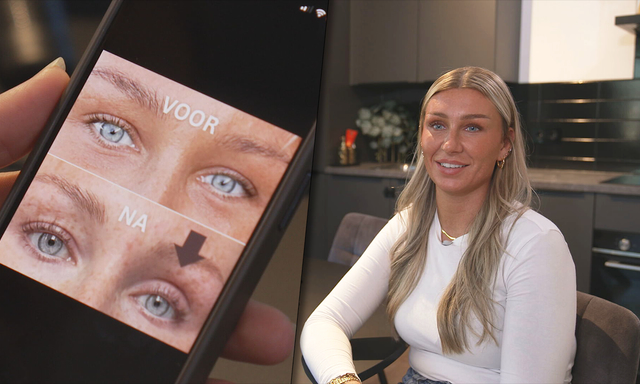 Afbeelding van Gebruik van populaire wimperserums niet zonder risico: "Kan blijvende oogschade veroorzaken"