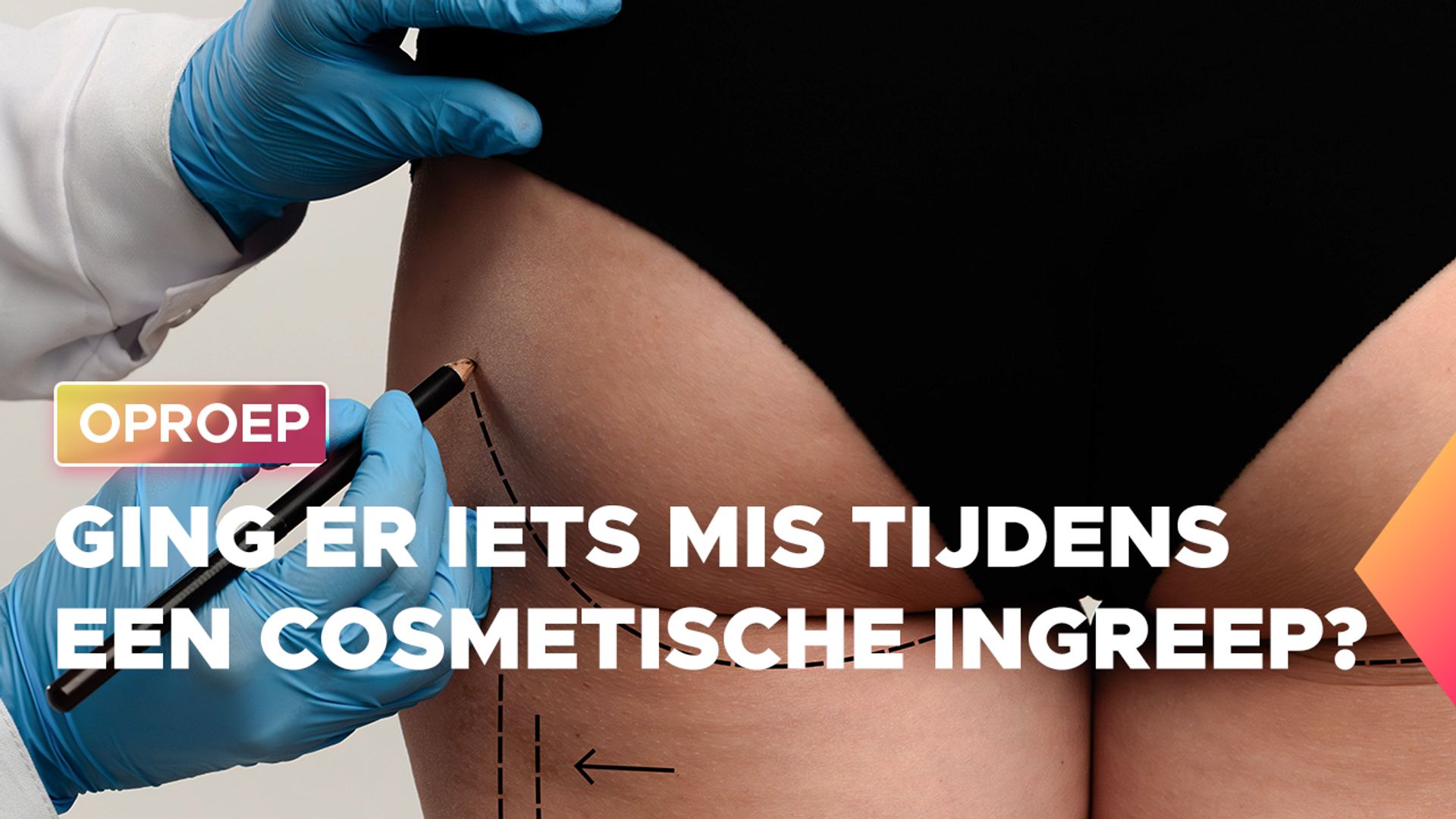 oproep cosmetiche ingreep2