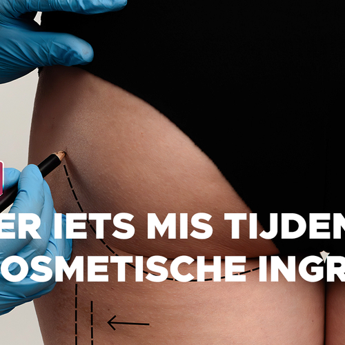 Oproep: ging er wat mis bij een cosmetische ingreep in Turkije?