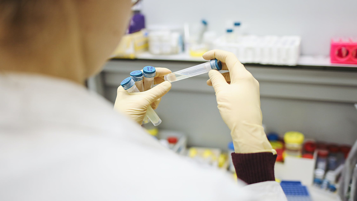 test laboratorium covid corona 1127