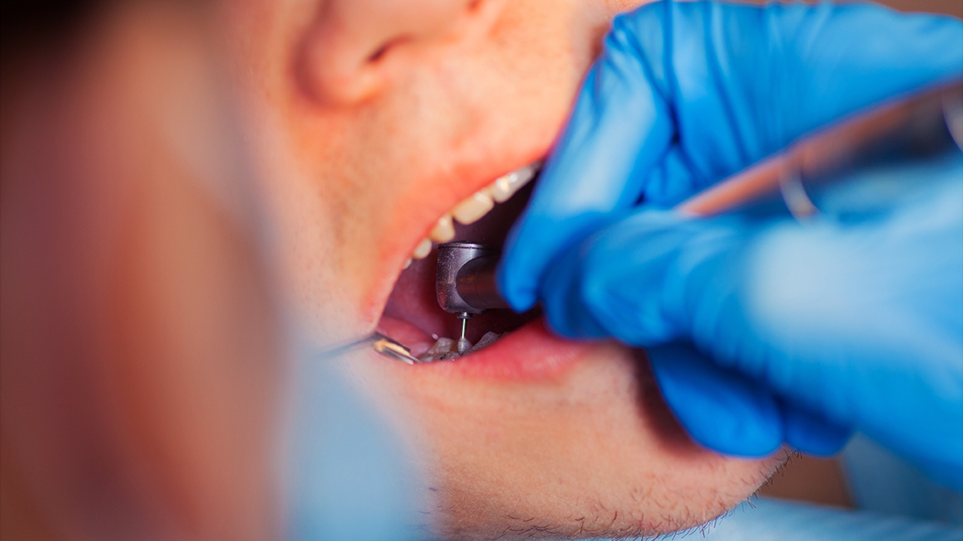 tandarts mondzorg
