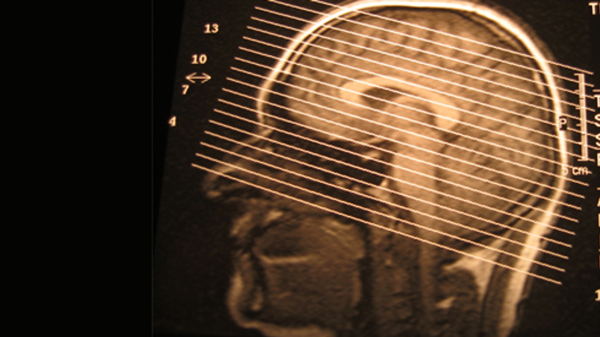 Zorg_software_MRI_t.jpg