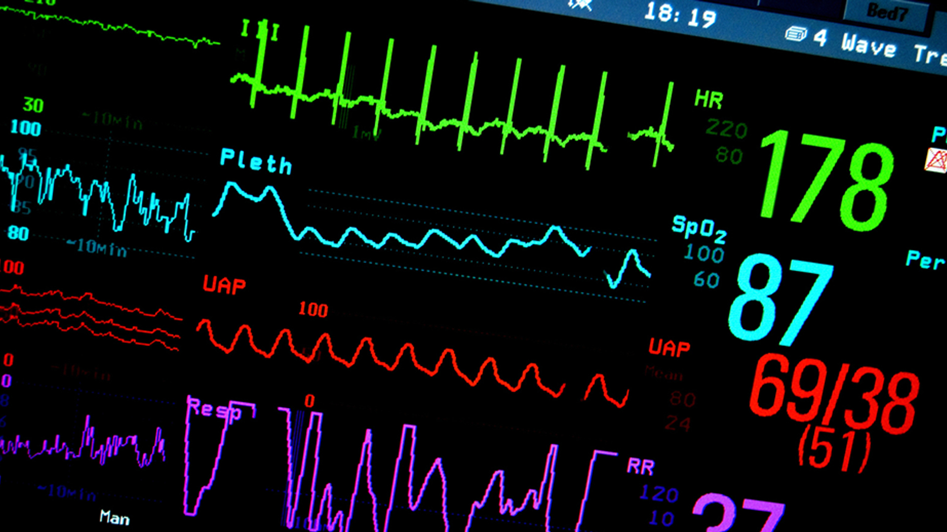 hart monitor 930x520