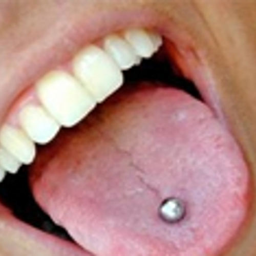 'Mondpiercing slecht voor gebit'