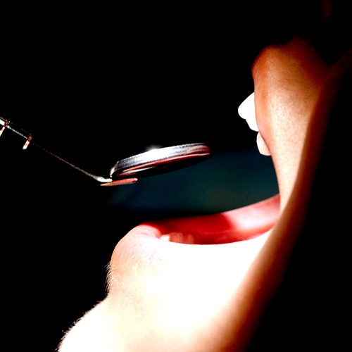 Afbeelding van Oproep: Factureert je tandarts te veel tijd voor de mondhygiënist?