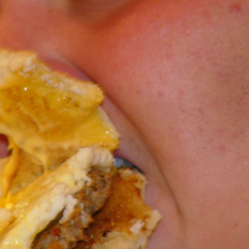 Ex-obesitaspatiënt moet van overtollig vel af