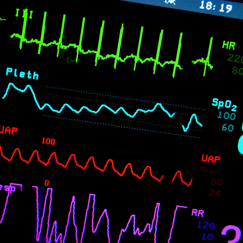 Onveilige pacemakers hebben update nodig