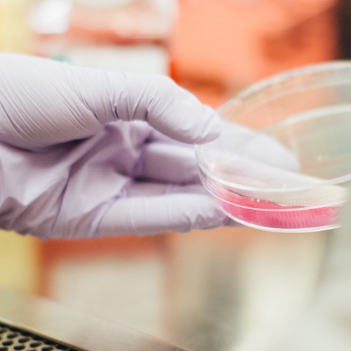 Nederland betaalt dubbel aan laboratoria voor analyse van coronatests